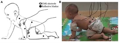 Inter-Limb Muscle Synergies and Kinematic Analysis of Hands-and-Knees Crawling in Typically Developing Infants and Infants With Developmental Delay